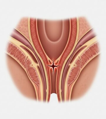 Recognizing the signs of anal fissures: pain, bleeding, and more explained for better understanding and relief.
